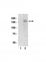 Anti-phospho-nNOS/NOS I (Ser1417) Antibody 
