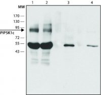 Anti-PIP5K1C (C-terminal) antibody produced in rabbit 