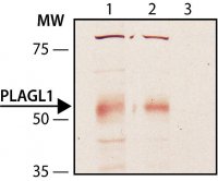 Anti-PLAGL1 antibody produced in rabbit