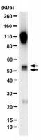 Anti-PLVAP Antibody, clone MECA-32 