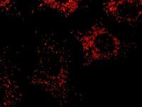 Anti-PMP70 antibody, Mouse monoclonal 