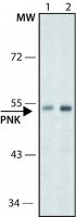 Anti-PNK antibody ,Mouse monoclonal 