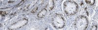 Anti-Podoplanin Antibody, clone LpMab-13 