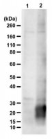 Anti-poly-(LPAC) 