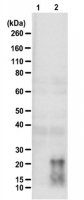 Anti-poly-(QAGR) 