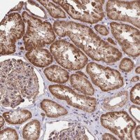 Anti-PPP1CA antibody produced in rabbit 