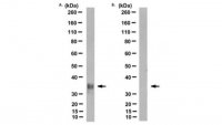 Anti-Prion Protein Antibody, clone POM2 