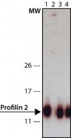 Anti-Profilin 2 (C-terminal) antibody produced in rabbit 
