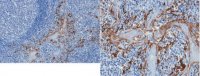 Anti-Properdin Antibody, clone 1G6D2 