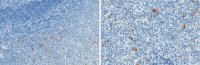 Anti-Properdin Antibody, clone 3A3E1 