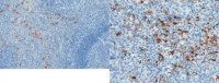 Anti-Properdin Antibody, clone 6E9E6 