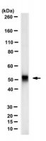 Anti-Properdin Antibody, clone 6E9E6 