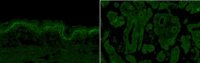 Anti-PTK7 Antibody, clone 31G9