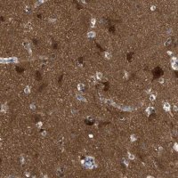 Anti-RAP1GDS1 antibody produced in rabbit 