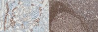 Anti-RecQ1 Antibody, clone 5A12.1 