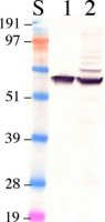 Anti-Retinal Pigment Epithelium 65 Antibody 