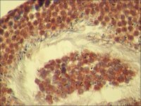 Anti-Rictor antibody produced in rabbit 
