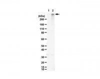 Anti-Ring Finger Protein 213 (RNF213)