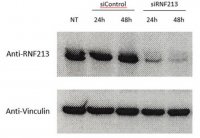 Anti-Ring Finger Protein 213 (RNF213)