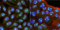 Anti-RRP8 Antibody, clone 5C7.1 