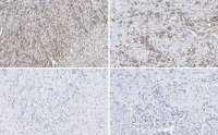 Anti-sACDY10 Antibody, clone R21 