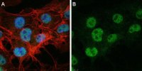 Anti-sACDY10 Antibody, clone R21 