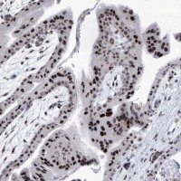 Anti-SART1 antibody produced in rabbit 