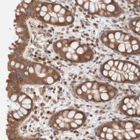 Anti-SIKE1 antibody produced in rabbit 