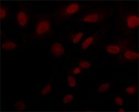 Anti-Sirt6 (N-terminal) antibody produced in rabbit 