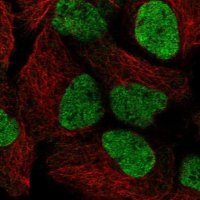 Anti-SMARCAL1 antibody produced in rabbit