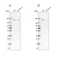 Anti-SMARCC2 antibody produced in rabbit 