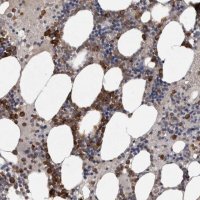 Anti-SRP68 antibody produced in rabbit 