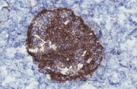 Anti-ST8SIA1 Antibody, clone HIC0-3C5 