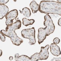 Anti-STT3A antibody produced in rabbit 