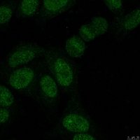 Anti-SUMO-2/3 Antibody, clone 8A2 