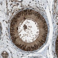Anti-TARDBP antibody produced in rabbit 