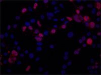 Anti-TNPO2 (C-terminal) antibody produced in rabbit 