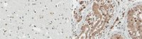 Anti-Transcription Initiation Factor IIA subunit 1 