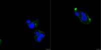 Anti-TRPV2 Antibody, clone 17A11 
