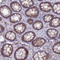 Anti-TTLL11 antibody produced in rabbit 