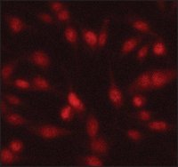 Anti-Twist1 antibody produced in rabbit 