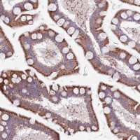 Anti-TYW1 antibody produced in rabbit 
