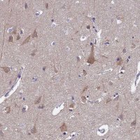 Anti-UBE2O antibody produced in rabbit 