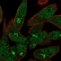 Anti-USP33 antibody produced in rabbit 