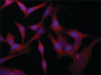 Anti-VAC14 (C-terminal) antibody produced in rabbit 