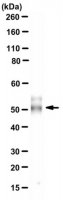 Anti-Vitamin D receptor Antibody, clone 9A7
