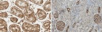 Anti-Wilms Tumor (WT33) 