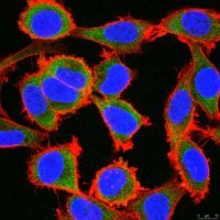 Anti-ZNF175 (OTK18) Antibody, clone 2113.11 