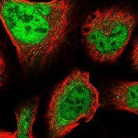 Anti-ZNF281 antibody produced in rabbit 