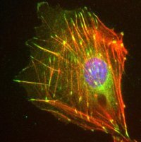 Anti-Zyxin 